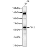 Western Blot - Anti-Chk2 Antibody [ARC57076] (A306128) - Antibodies.com