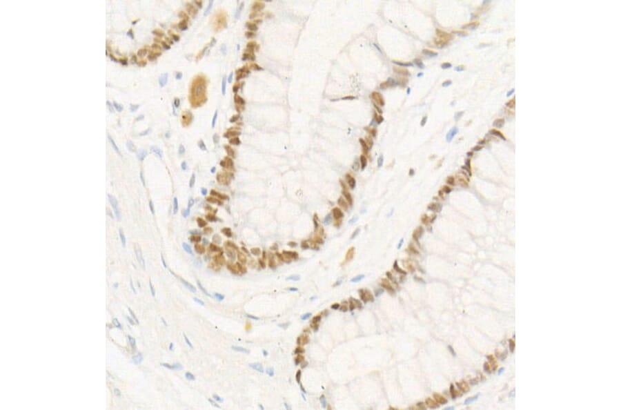 Immunohistochemistry - Anti-Chk2 Antibody [ARC57076] (A306128) - Antibodies.com