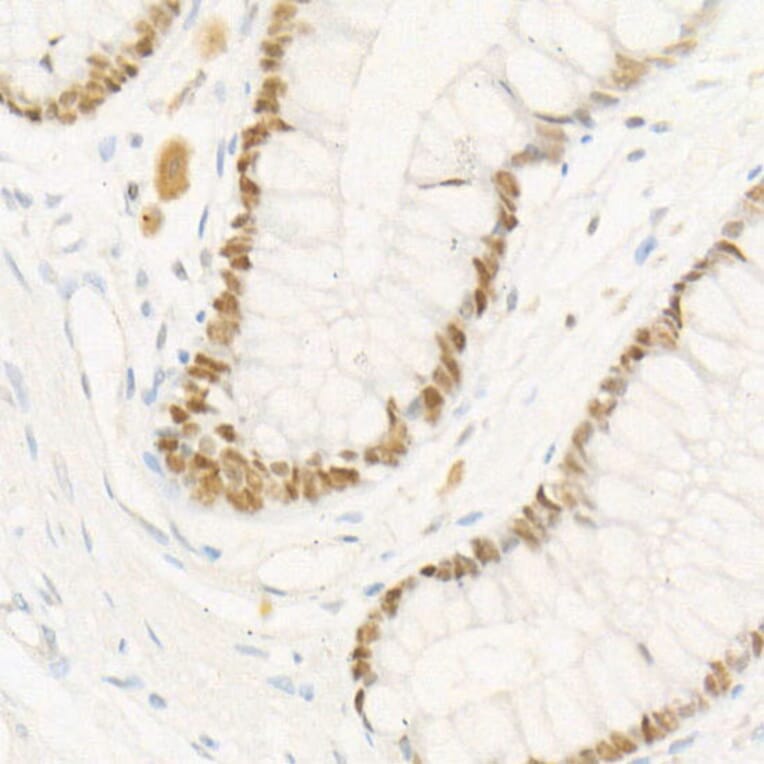 Immunohistochemistry - Anti-Chk2 Antibody [ARC57076] (A306128) - Antibodies.com