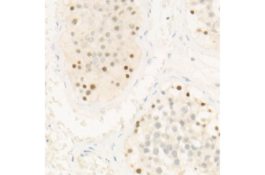 Immunohistochemistry - Anti-Chk2 Antibody [ARC57076] (A306128) - Antibodies.com