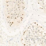 Immunohistochemistry - Anti-Chk2 Antibody [ARC57076] (A306128) - Antibodies.com