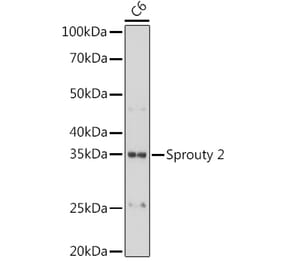 Western Blot - Anti-Spry-2 Antibody [ARC1753] (A306129) - Antibodies.com