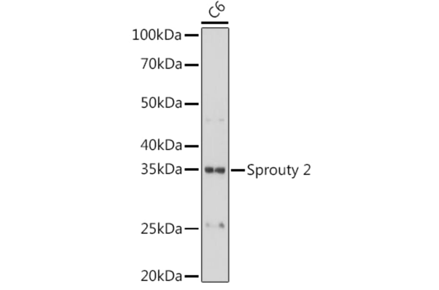 Western Blot - Anti-Spry-2 Antibody [ARC1753] (A306129) - Antibodies.com