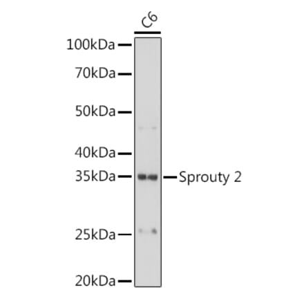 Western Blot - Anti-Spry-2 Antibody [ARC1753] (A306129) - Antibodies.com