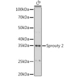 Western Blot - Anti-Spry-2 Antibody [ARC1753] (A306129) - Antibodies.com