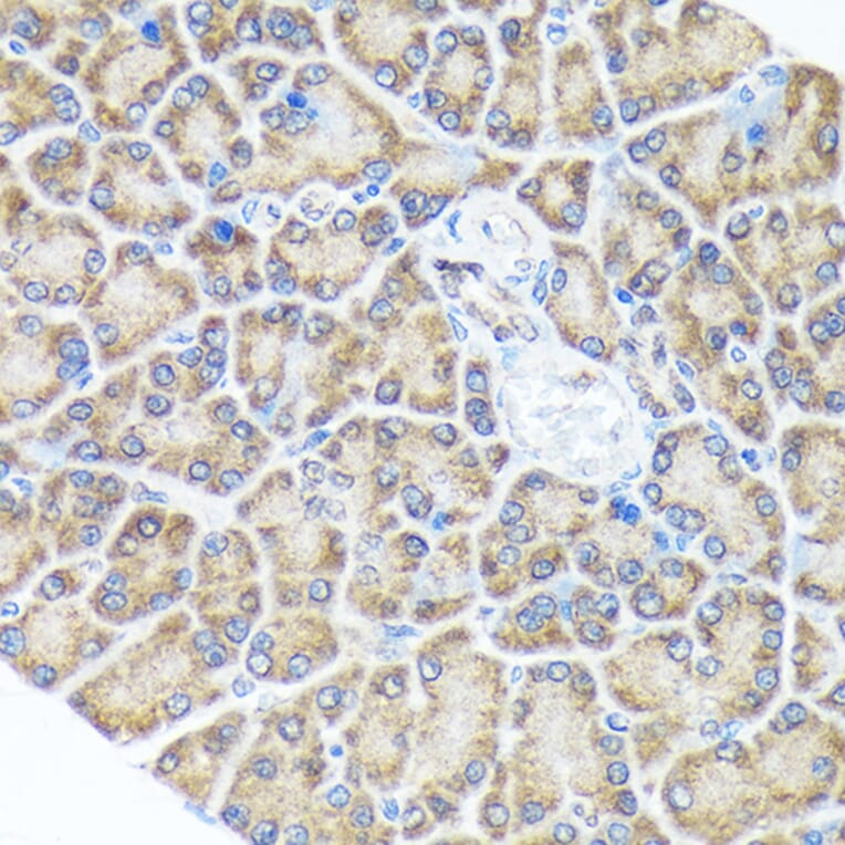 Immunohistochemistry - Anti-Spry-2 Antibody [ARC1753] (A306129) - Antibodies.com