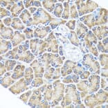 Immunohistochemistry - Anti-Spry-2 Antibody [ARC1753] (A306129) - Antibodies.com