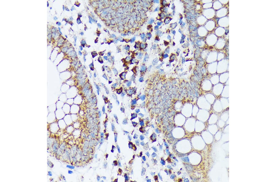 Immunohistochemistry - Anti-Spry-2 Antibody [ARC1753] (A306129) - Antibodies.com