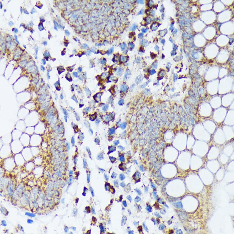 Immunohistochemistry - Anti-Spry-2 Antibody [ARC1753] (A306129) - Antibodies.com