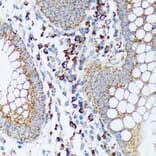 Immunohistochemistry - Anti-Spry-2 Antibody [ARC1753] (A306129) - Antibodies.com