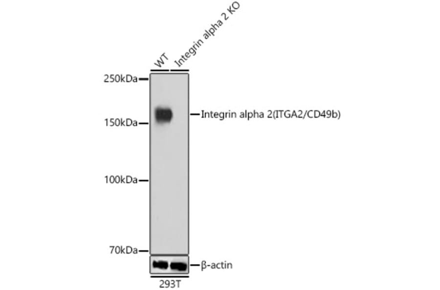Western Blot - Anti-Integrin alpha 2 Antibody [ARC0457] (A306130) - Antibodies.com