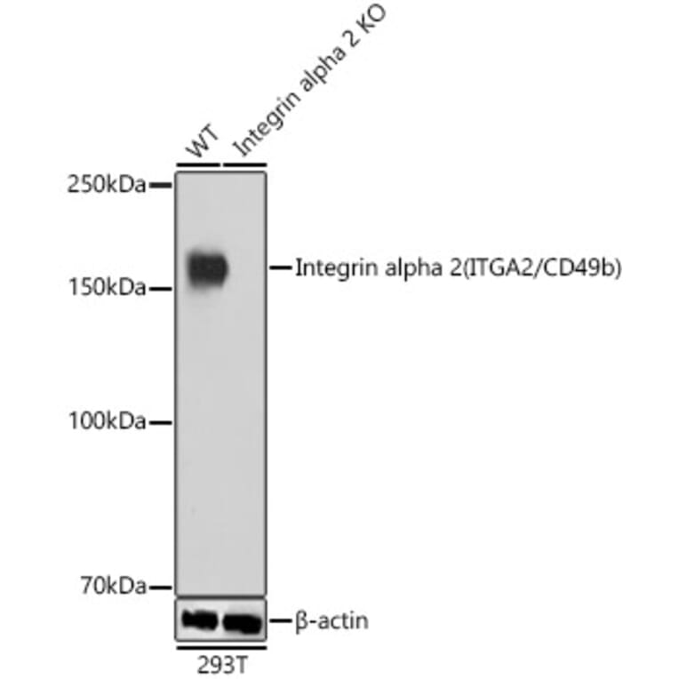 Western Blot - Anti-Integrin alpha 2 Antibody [ARC0457] (A306130) - Antibodies.com