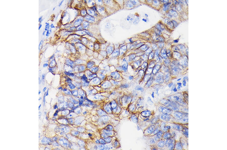Immunohistochemistry - Anti-Integrin alpha 2 Antibody [ARC0457] (A306130) - Antibodies.com