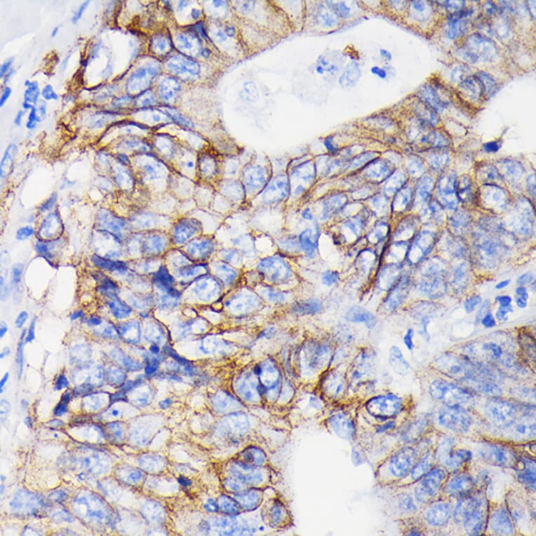 Immunohistochemistry - Anti-Integrin alpha 2 Antibody [ARC0457] (A306130) - Antibodies.com