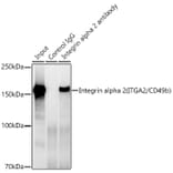 Western Blot - Anti-Integrin alpha 2 Antibody [ARC0457] (A306130) - Antibodies.com