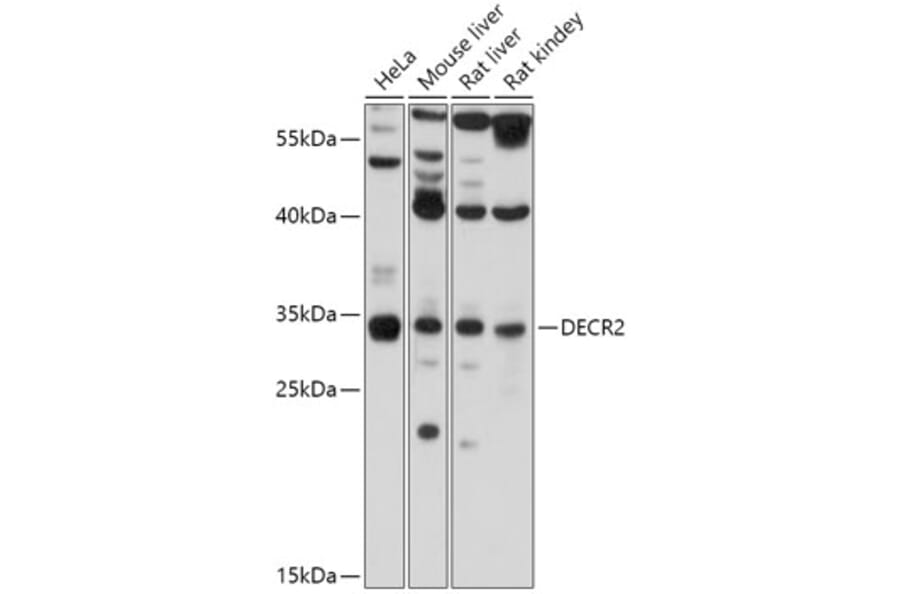 Western Blot - Anti-DECR2/PDCR Antibody (A306131) - Antibodies.com