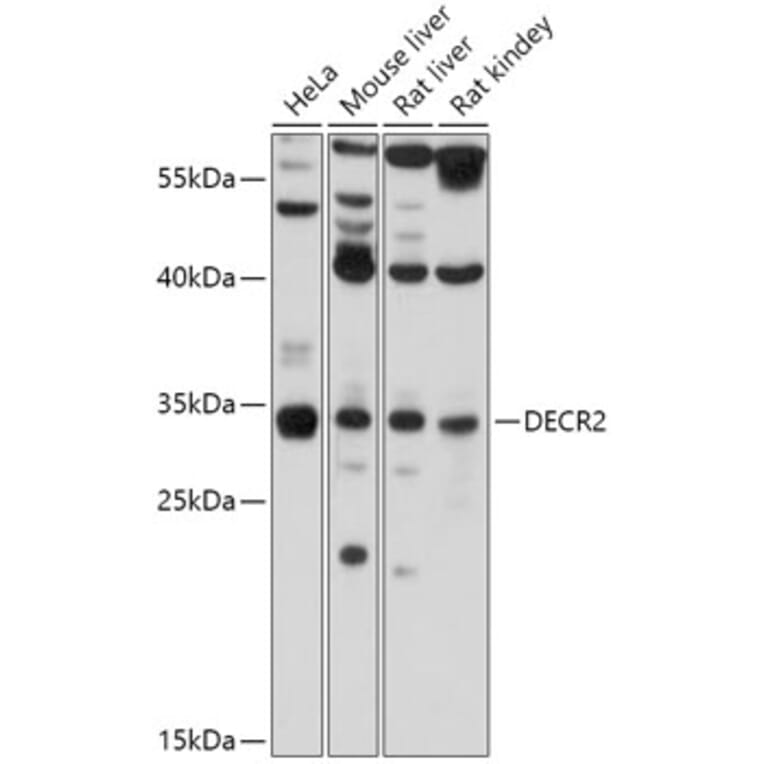 Western Blot - Anti-DECR2/PDCR Antibody (A306131) - Antibodies.com