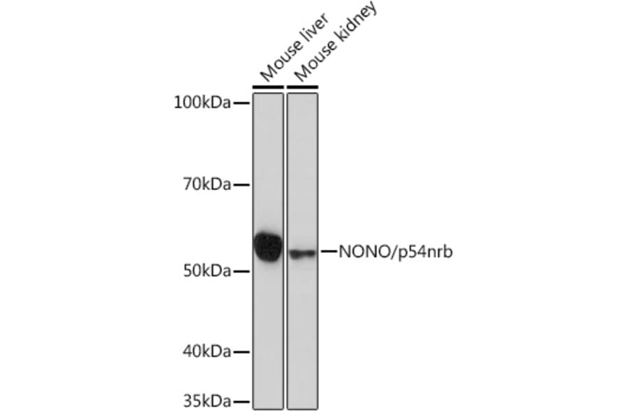 Western Blot - Anti-nmt55/p54nrb Antibody [ARC0836] (A306132) - Antibodies.com