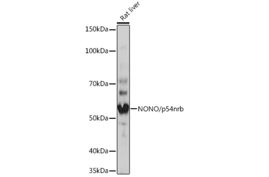 Western Blot - Anti-nmt55/p54nrb Antibody [ARC0836] (A306132) - Antibodies.com