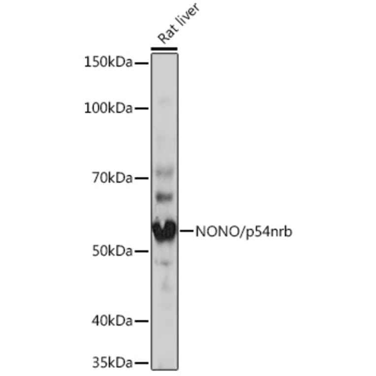 Western Blot - Anti-nmt55/p54nrb Antibody [ARC0836] (A306132) - Antibodies.com