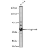Western Blot - Anti-nmt55/p54nrb Antibody [ARC0836] (A306132) - Antibodies.com