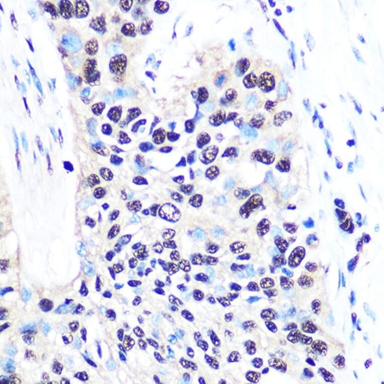 Immunohistochemistry - Anti-nmt55/p54nrb Antibody [ARC0836] (A306132) - Antibodies.com