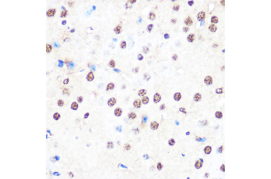 Immunohistochemistry - Anti-nmt55/p54nrb Antibody [ARC0836] (A306132) - Antibodies.com