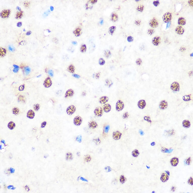 Immunohistochemistry - Anti-nmt55/p54nrb Antibody [ARC0836] (A306132) - Antibodies.com