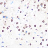 Immunohistochemistry - Anti-nmt55/p54nrb Antibody [ARC0836] (A306132) - Antibodies.com