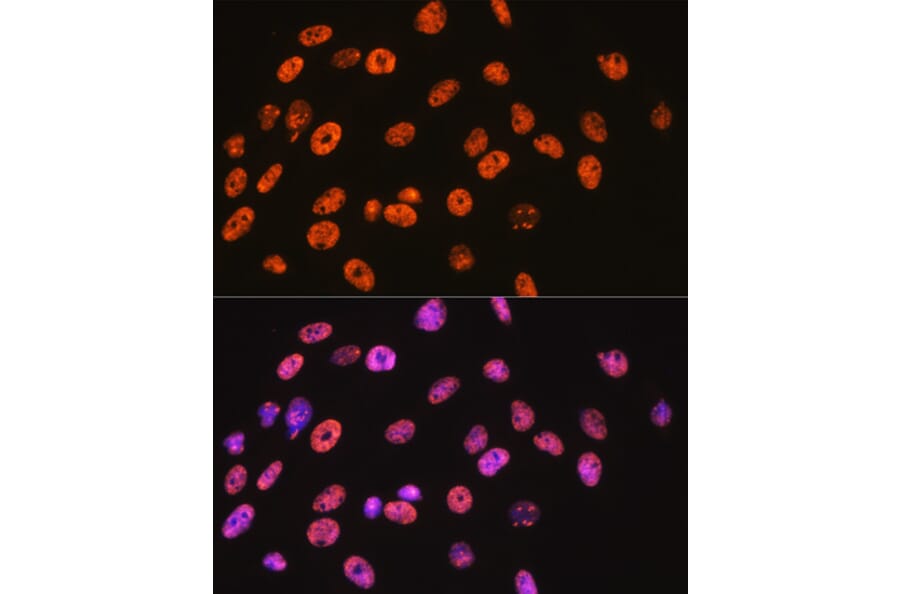 Immunofluorescence - Anti-nmt55/p54nrb Antibody [ARC0836] (A306132) - Antibodies.com