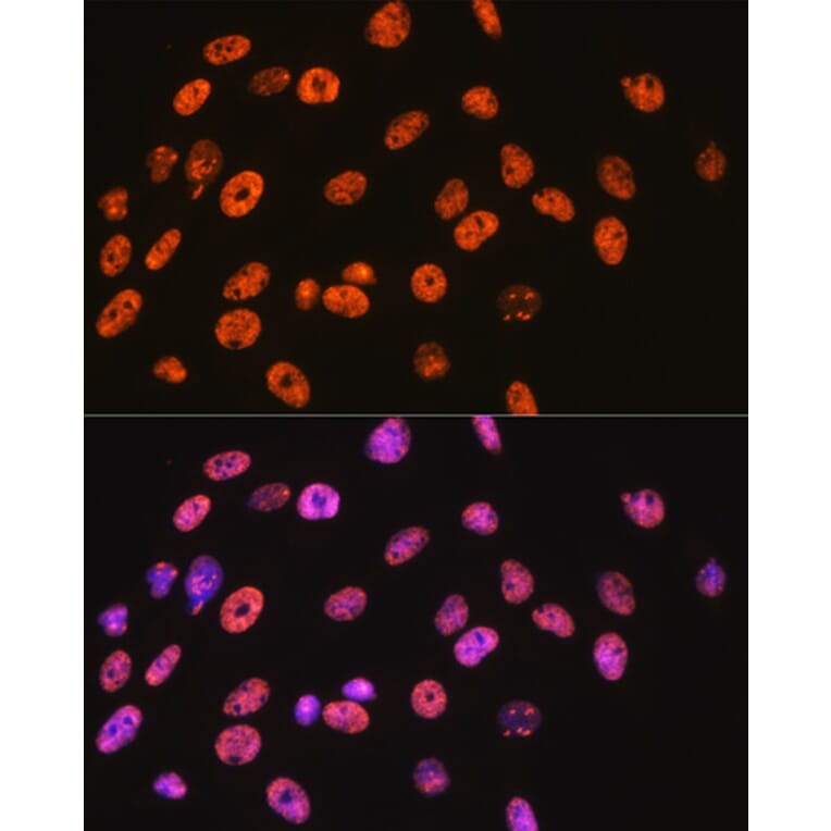 Immunofluorescence - Anti-nmt55/p54nrb Antibody [ARC0836] (A306132) - Antibodies.com