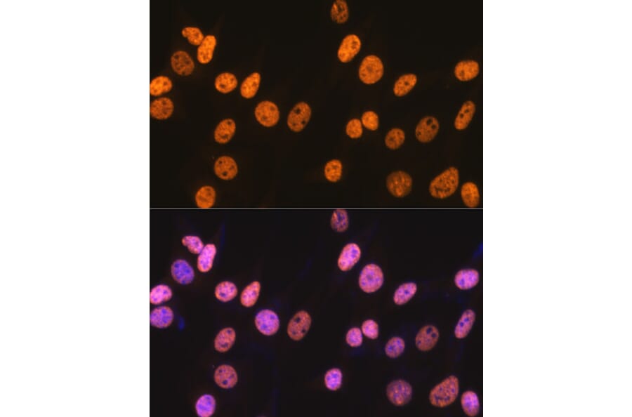 Immunofluorescence - Anti-nmt55/p54nrb Antibody [ARC0836] (A306132) - Antibodies.com