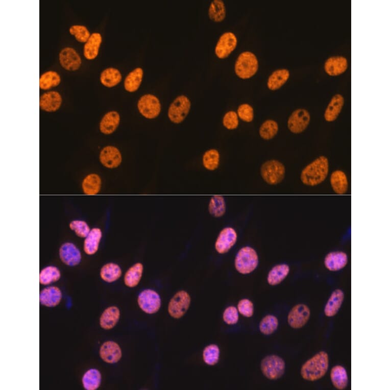Immunofluorescence - Anti-nmt55/p54nrb Antibody [ARC0836] (A306132) - Antibodies.com