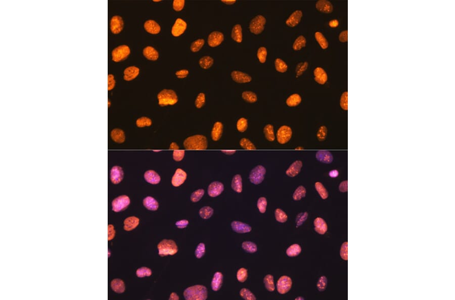 Immunofluorescence - Anti-nmt55/p54nrb Antibody [ARC0836] (A306132) - Antibodies.com