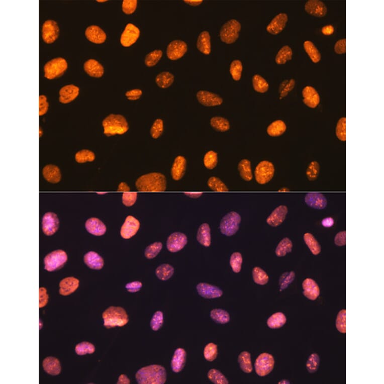 Immunofluorescence - Anti-nmt55/p54nrb Antibody [ARC0836] (A306132) - Antibodies.com