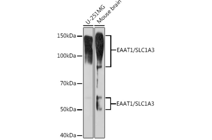 Western Blot - Anti-EAAT1 Antibody [ARC1714] (A306133) - Antibodies.com