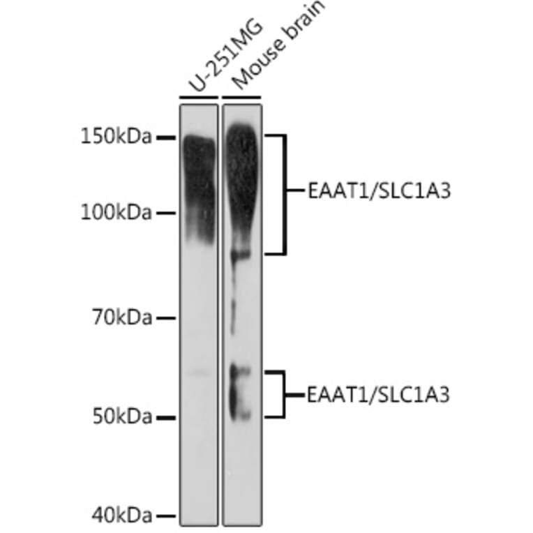 Western Blot - Anti-EAAT1 Antibody [ARC1714] (A306133) - Antibodies.com