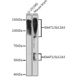 Western Blot - Anti-EAAT1 Antibody [ARC1714] (A306133) - Antibodies.com
