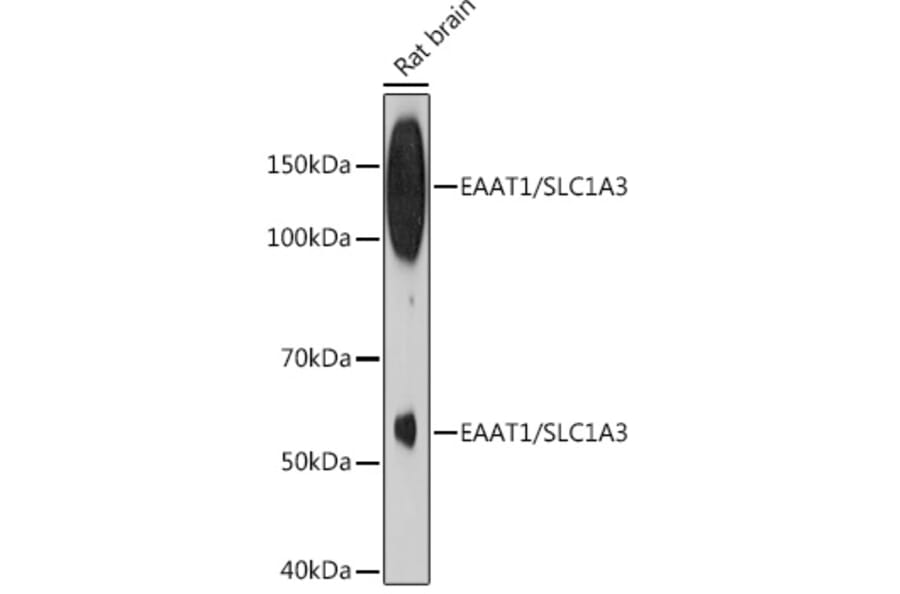 Western Blot - Anti-EAAT1 Antibody [ARC1714] (A306133) - Antibodies.com