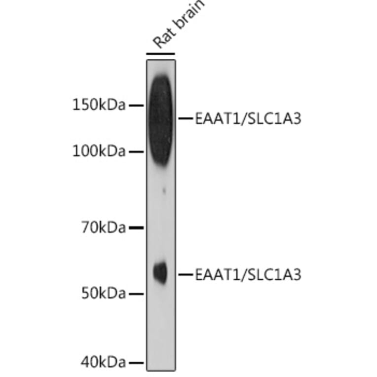Western Blot - Anti-EAAT1 Antibody [ARC1714] (A306133) - Antibodies.com
