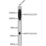 Western Blot - Anti-EAAT1 Antibody [ARC1714] (A306133) - Antibodies.com