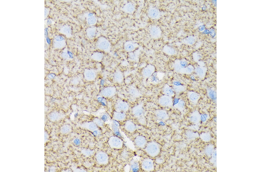 Immunohistochemistry - Anti-EAAT1 Antibody [ARC1714] (A306133) - Antibodies.com