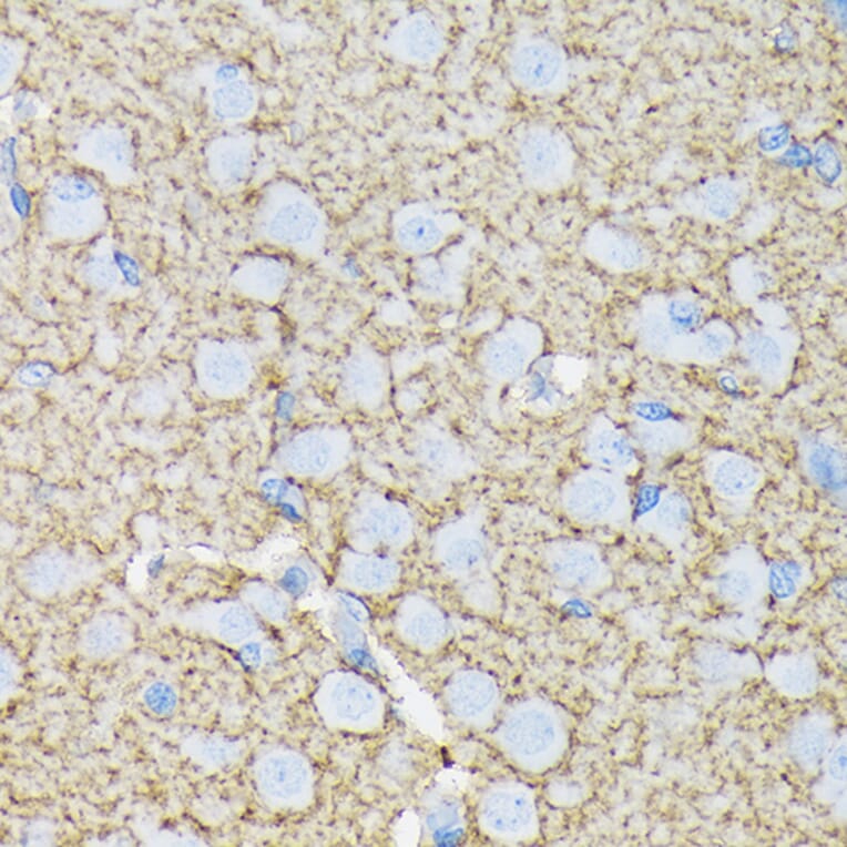 Immunohistochemistry - Anti-EAAT1 Antibody [ARC1714] (A306133) - Antibodies.com