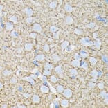 Immunohistochemistry - Anti-EAAT1 Antibody [ARC1714] (A306133) - Antibodies.com