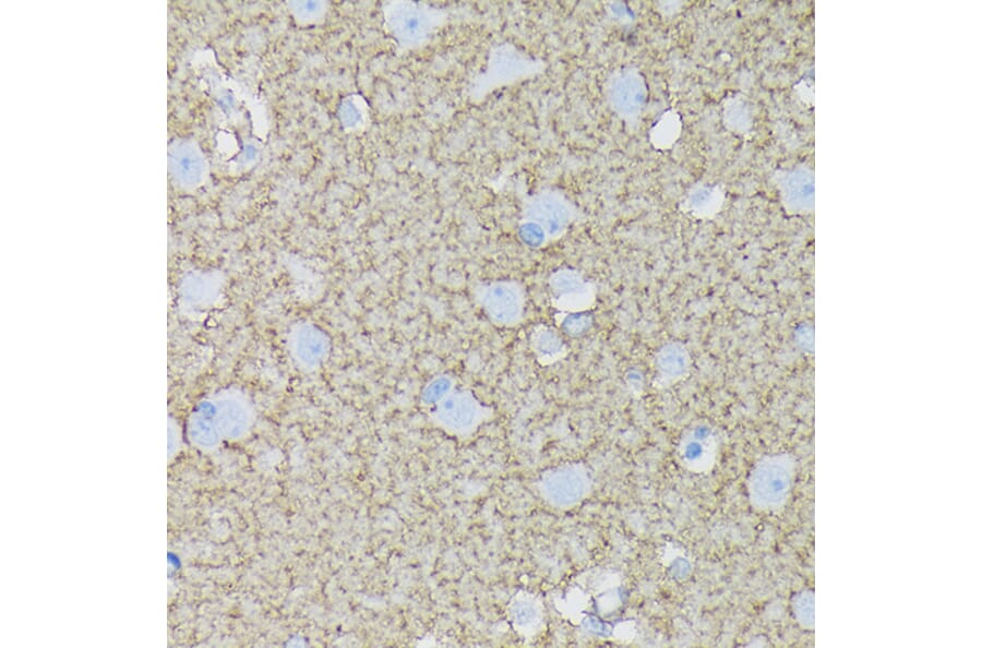 Immunohistochemistry - Anti-EAAT1 Antibody [ARC1714] (A306133) - Antibodies.com