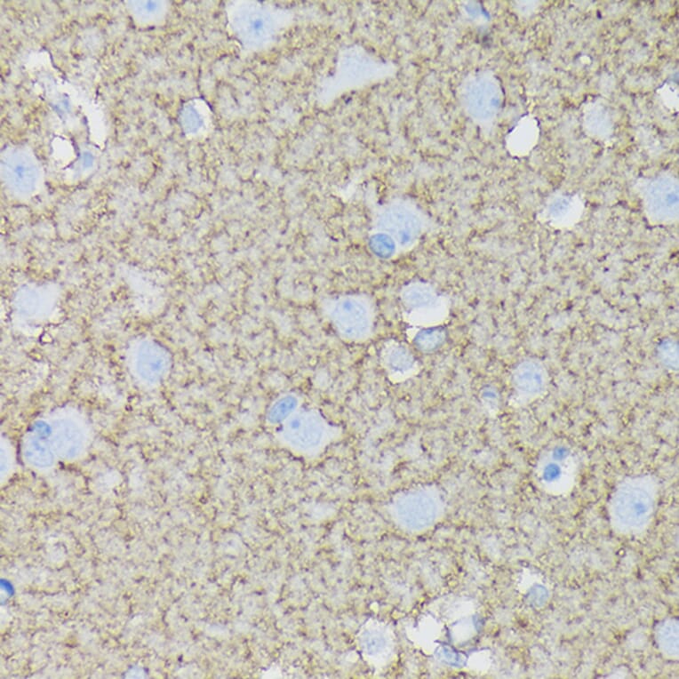 Immunohistochemistry - Anti-EAAT1 Antibody [ARC1714] (A306133) - Antibodies.com