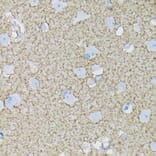 Immunohistochemistry - Anti-EAAT1 Antibody [ARC1714] (A306133) - Antibodies.com