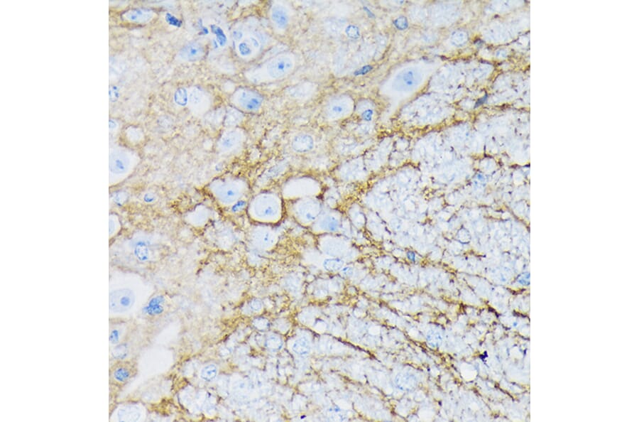 Immunohistochemistry - Anti-EAAT1 Antibody [ARC1714] (A306133) - Antibodies.com