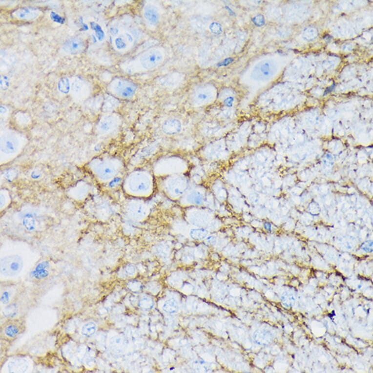 Immunohistochemistry - Anti-EAAT1 Antibody [ARC1714] (A306133) - Antibodies.com