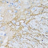 Immunohistochemistry - Anti-EAAT1 Antibody [ARC1714] (A306133) - Antibodies.com